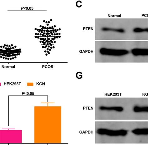 Ff And Gcs Had Lower Levels Of Mir B P And Higher Levels Of Pten In