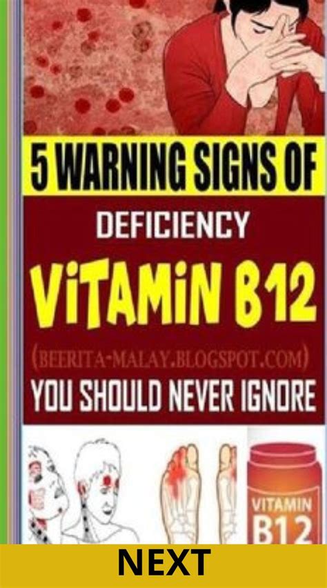 Never Ignore These Warning Signs Of Vitamin B12 Deficiency Vitamin B12 Health Signs Women