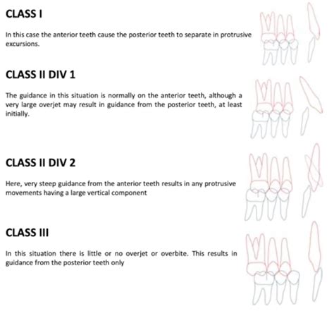 Occlusion Flashcards Quizlet