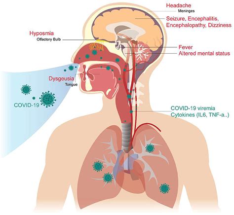 Frontiers The Neurologic Manifestations Of Coronavirus Disease 2019