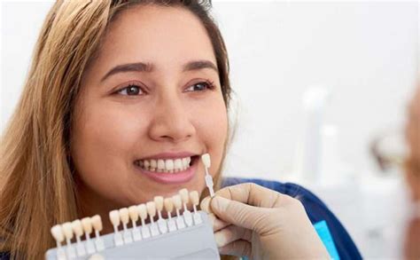 Our Services Nova Smile Dental