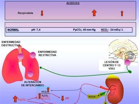 Cidosis Y Alcalosis Basica Sencilla Ppt