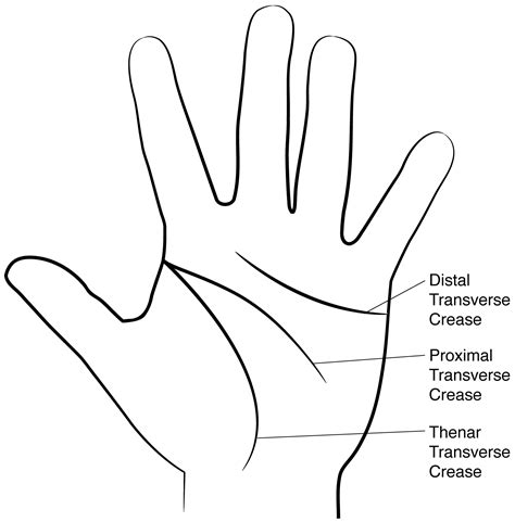 Distal And Proximal Crease In Hand