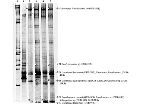 Denaturing Gradient Gel Electrophoresis Dgge Of Pcr Amplified 16s Download Scientific Diagram