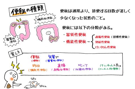 便秘の種類覚え方。「便秘気質で、昨日直接叱ってけいれんした。」で覚えてみよう。 マンガで看護師国家試験にうかーる。