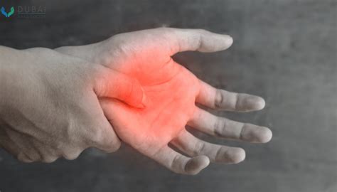 Hand Tendon Injuries Causes Treatments And Prevention