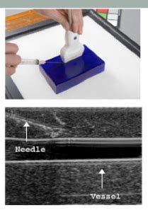 Ultrasound Basics Ppt Flashcards Quizlet