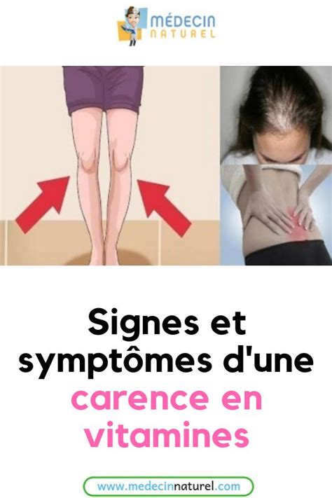 Voici Les Signes D Une Carence En Vitamine Que Vous Devez Contr Ler