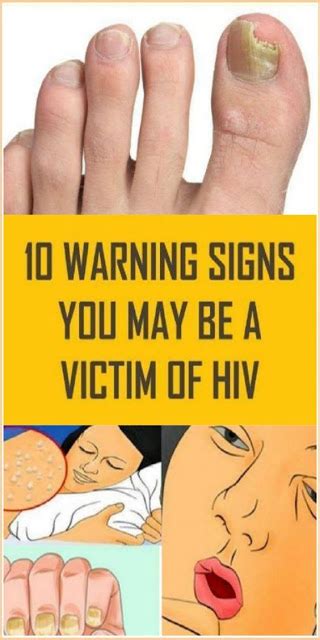 10 Warning Signs You May Be A Victim Of Hiv Medicine Health Life