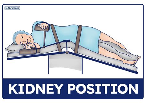 Patient Positioning Complete Guide And Cheat Sheet For Nurses