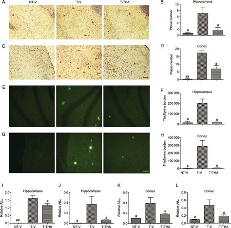 THA reduced senile plaques in the APP/PS1 transgenic mice. (A) An image ... 