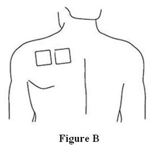 Buprenorphine Patch: Package Insert - Drugs.com