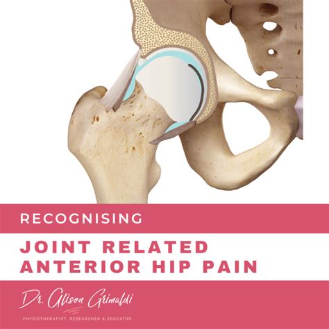 Differential Diagnosis Of Anterior Hip Pain Joint Dr Alison Grimaldi