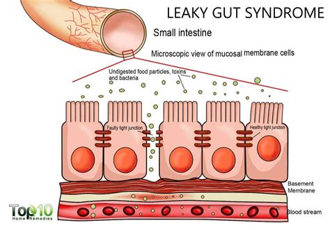 Understanding Increased Intestinal Permeability The Impact On Your Health And Wellness