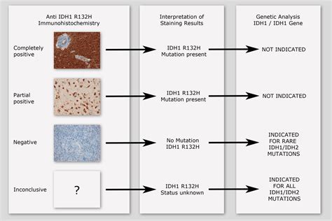 Glioma: Idh Mutation Glioma