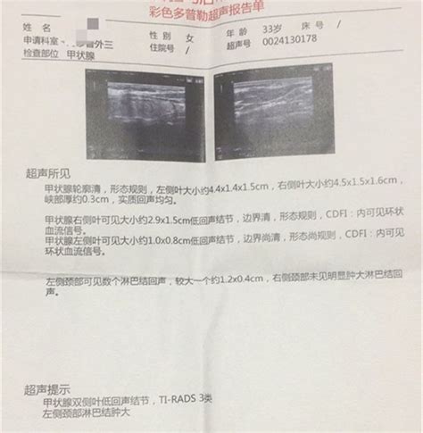 【教你正确认识甲状腺结节】 详细页