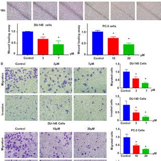 NC Inhibited Prostate Cancer Cell Migration And Invasion A Top Panel