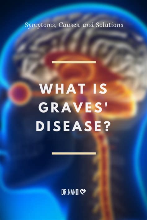 What Is Graves Disease Symptoms Causes And Solutions Artofit