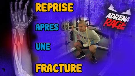 Comment Reprendre La Musculation Apr S Une Fracture Youtube