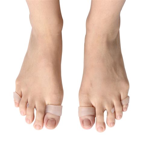 Órtese De Silicone Macio Para Hallux Valgus Dedo Do Pé Sobreposição E