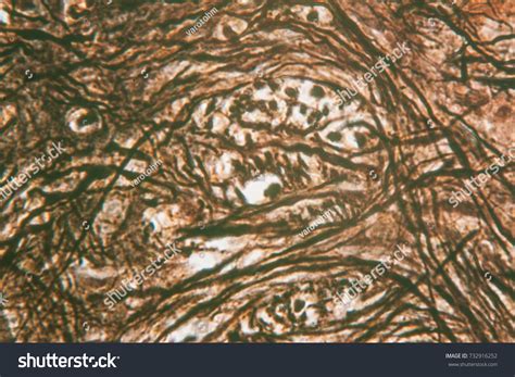 Spinal Cord Under Microscope 100x Stock Photo 732916252 | Shutterstock