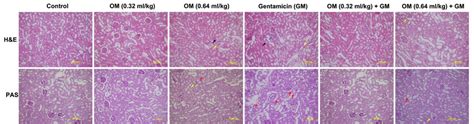 H&E and PAS staining in the kidney tissues. In the Control, OM (0.32... | Download Scientific ...