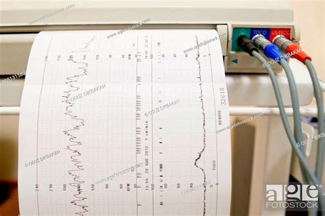 Cardiogram test Ekg heart pulse results on the graph paper, Stock Photo ...