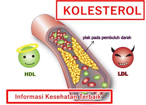 6 Tanda Dan Penyebab Penyakit Kolesterol Info Kesehatan Terbaik