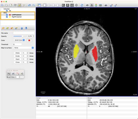 Appendix C Annotating Anatomical Images With Freeview Andy S Brain