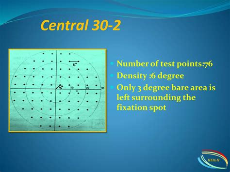 Humphrey Visual Field Analyser Hvfa Ppt