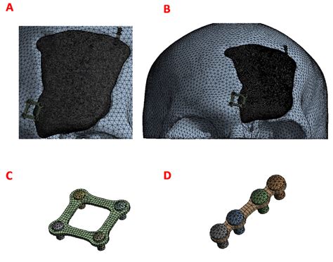 Mesh elements: Mesh of the implant with the fixation systems towards... | Download Scientific ...