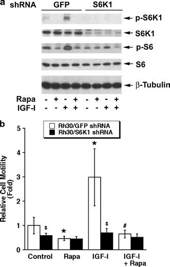 Rapamycin Inhibits Cell Motility By Suppression Of Mtor Mediated S6k1 And 4e Bp1 Pathways Oncogene