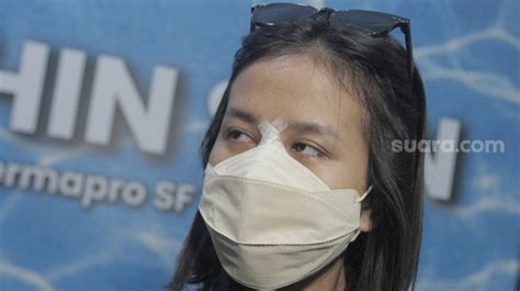 Ini Jenis Operasi Hidung Mayang Pakai Prosedur Yang Mana