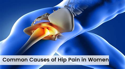 Common Causes Of Hip Pain In Women Drsumitz