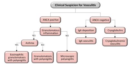 Management Of Primary Small Vessel Vasculitis