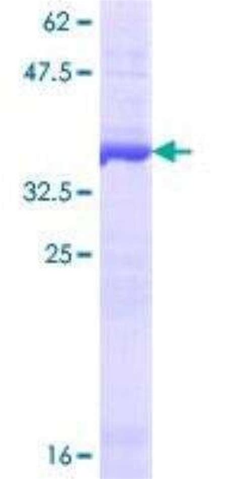 Novus Biologicals Recombinant Human Drosha GST N Term Protein 25 μg