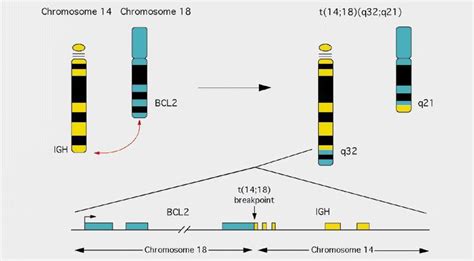 Pathology Outlines BCL2