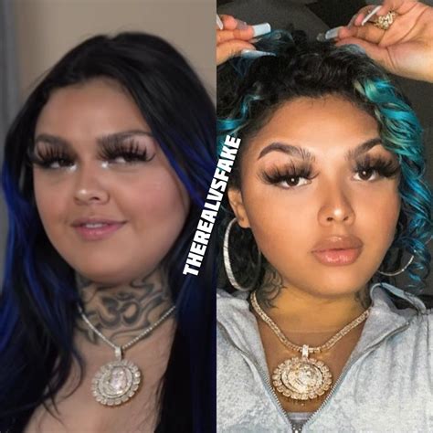 Blueface Baby Mama Jaidyn Alexis Reality Vs Instagram Botox Fillers