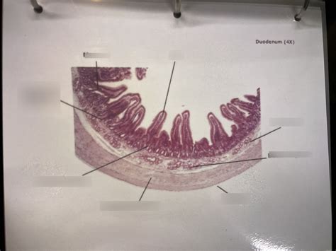 Duodenum Diagram Quizlet