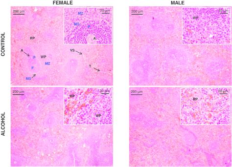 Representative Images After Histological Analysis Of Spleen Sections