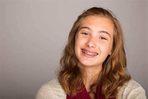 Braces For Beginners Band And Wire Orthodontics