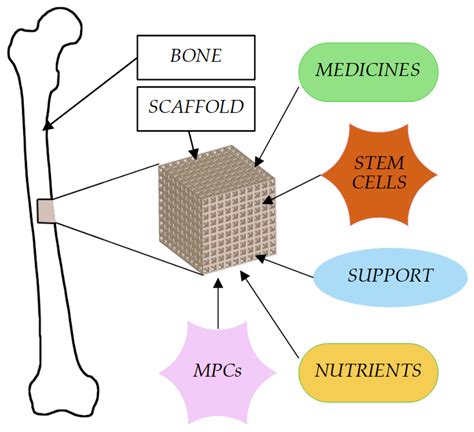 Cells Free Full Text Application Of 3D Printing In Bone Grafts