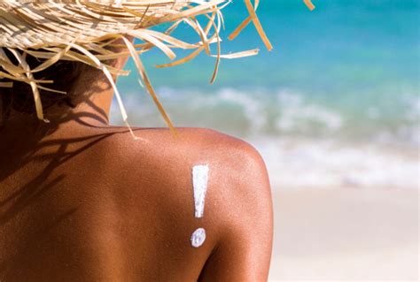 How To Prevent And Soothe Sunburns