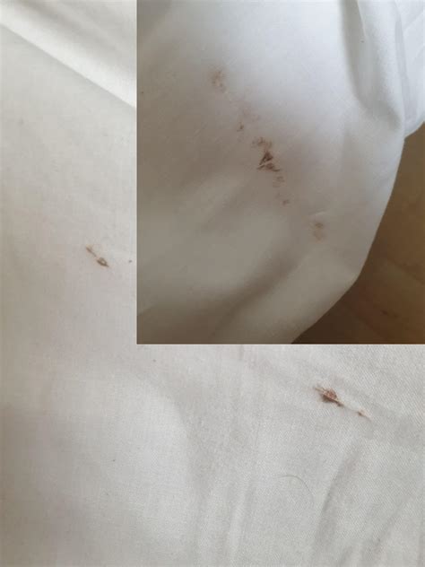 Blood Stains Sheets Bed Bugs Informacionpublicasvetgobgt