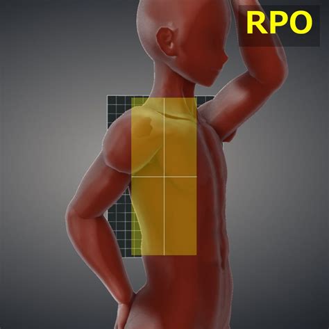 Thoracic Spine Oblique Viewtools For Radtech