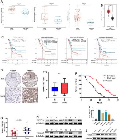 FBXO28 Promotes Proliferation Invasion And Metastasis Of Pancreatic