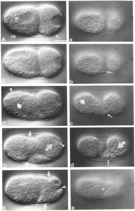 Effect Of Nocodazole On Cleavage Of Ab And P A Embryo Permeabilized