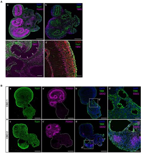 Frontiers A Simplified Protocol For The Generation Of Cortical Brain