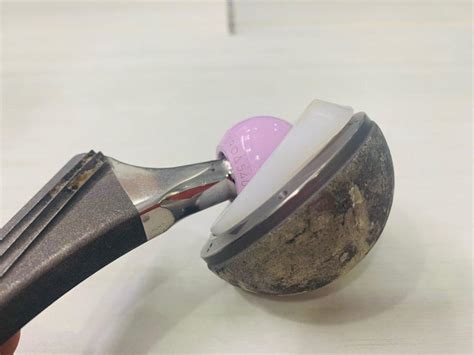 hip replacement surgeon  delhi india dr pankaj walecha