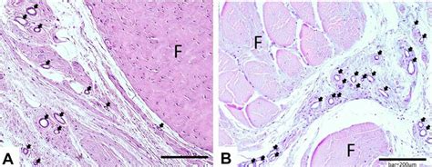 Gross Anatomical Views Of Acl And Its Cross Sections A The Solid Red